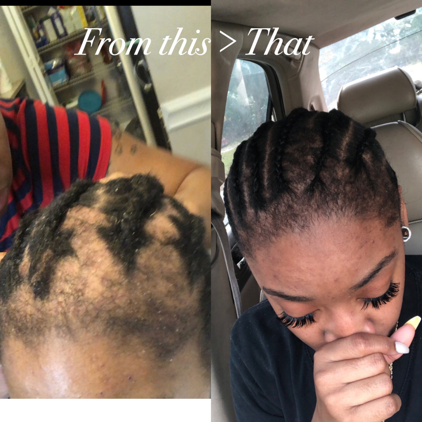 Royal Hair Growth Oil